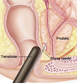 Prostate Stimulated